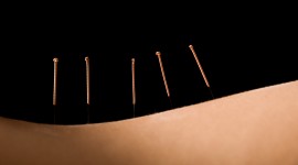 Acupuncture High Quality Wallpaper