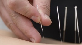 Acupuncture Wallpaper Gallery