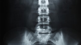 X-Ray Wallpaper For IPhone Free