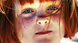 Red Haired Children Photo Download
