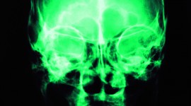 Head X-Ray Wallpaper For IPhone