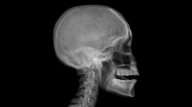 Head X-Ray Wallpaper For PC