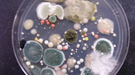 Bacteria In A Petri Dish High Quality Wallpaper