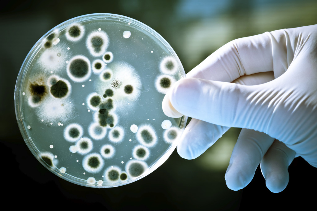 Bacteria In A Petri Dish wallpapers HD