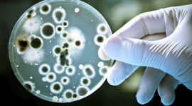 Bacteria In A Petri Dish Wallpaper Download
