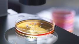 Bacteria In A Petri Dish Wallpaper Download Free