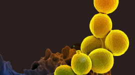 Bacteria In A Petri Dish Wallpaper For IPhone