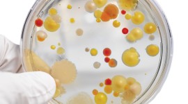 Bacteria In A Petri Dish Wallpaper For IPhone Download