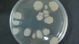 Bacteria In A Petri Dish Wallpaper For PC