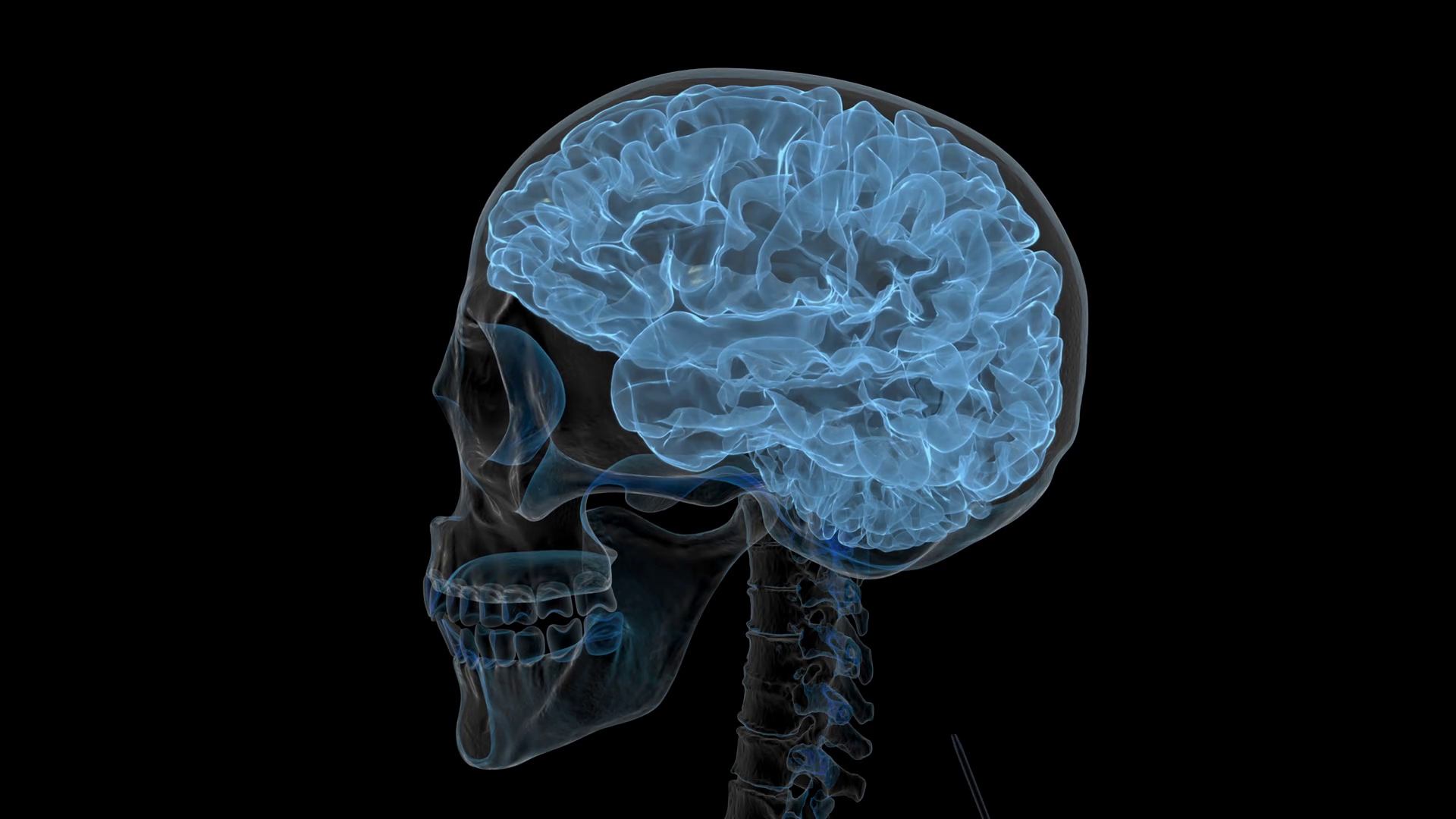 Мозги в черепной коробке. Рентген мозга. Рентгеновский снимок мозга.