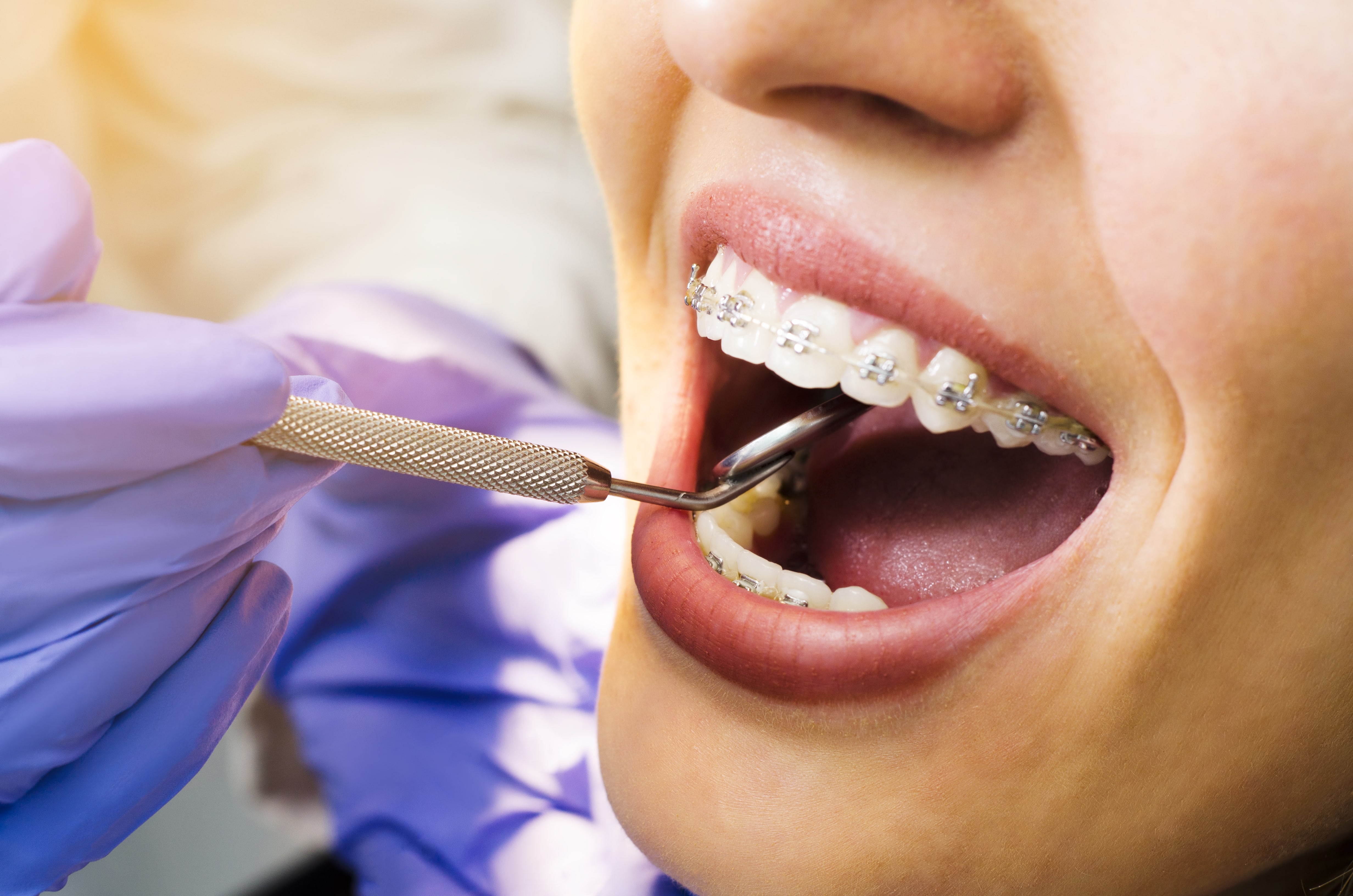 Как стоматологи делают чистку зубов. Стоматолог ортодонт. Ортодонтия в стоматологии. Зуба стоматология брекеты.